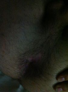 hole
