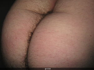 Ass