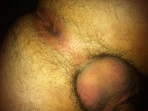 Hairy Beefy Arse
