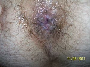fat hairy ass