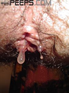 Stom Dripping 24