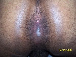 My Hairy Cumhole