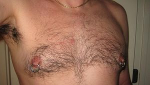 Nipples
