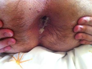 IMG 1202