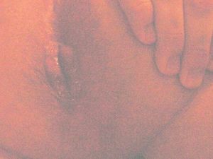 MY HOLE WITH CUM IN IT 003