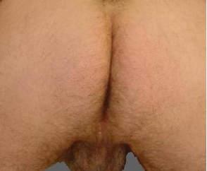 ass