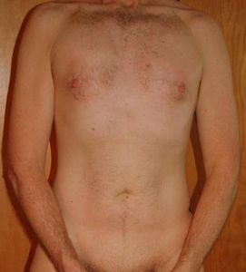 chest