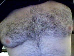 chest1