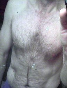chest