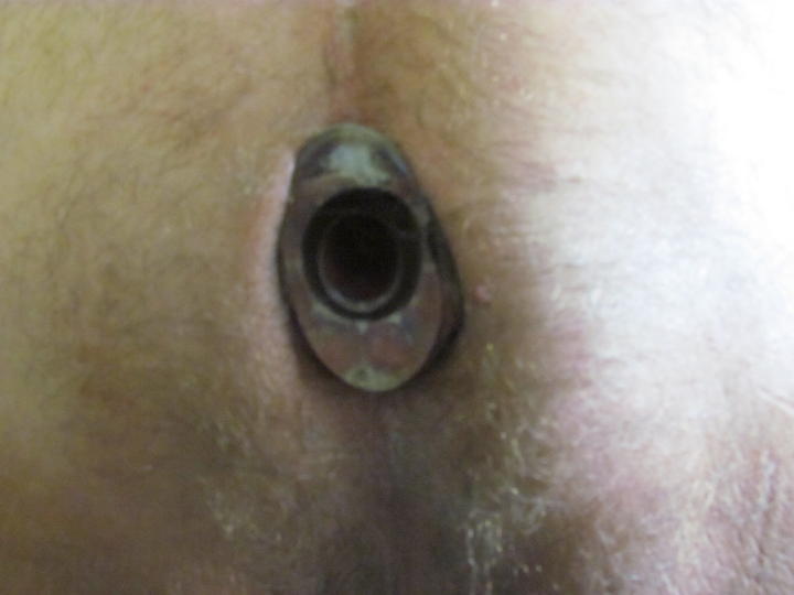 Piss hole plug