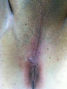 Freshly shaven hole ready to be fucked by a Fat Black Cock