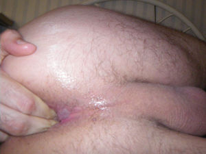 few fingers