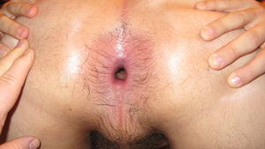 Hole