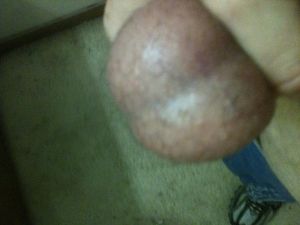 My Balls