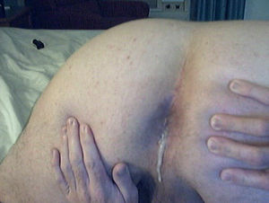 ass running out of my ass