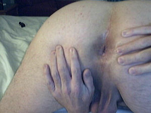 pics of my my ass spread apart