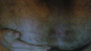 tight hole