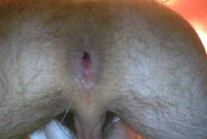 Dripping