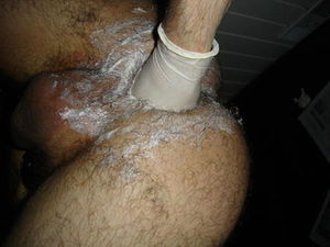 Hairy Arse