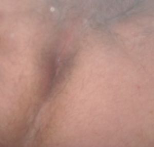 robro1