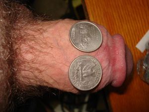 1