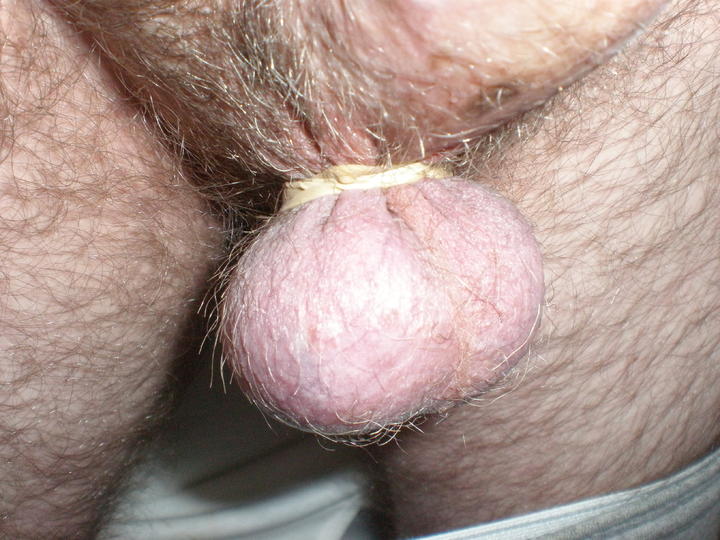 Fun with Rubber Band