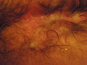 cumsickle4 14 2009 025