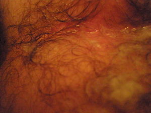 cumsickle4 14 2009 026