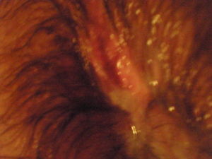cumsickle4 14 2009 027
