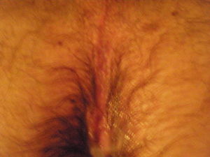 cumsickle4 14 2009 028