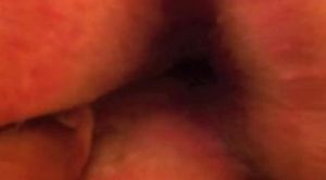 My open hole