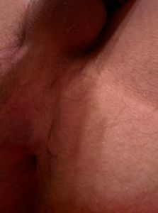 Close up 1