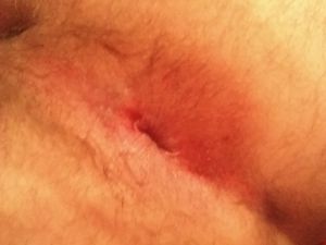 Close up 5