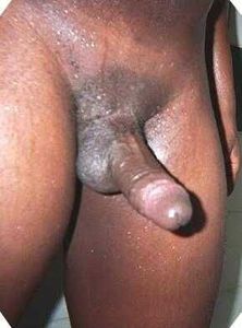 picCAK0G3IX