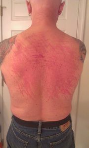 My back Oct 10, 2014