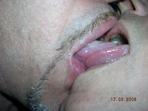 pelleojus