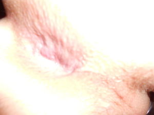 cum drip