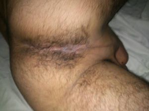 3Ga3F93Nc5L15Fc5Mcd5cd82f88151bfc155c