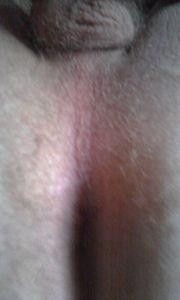 IMAG1178