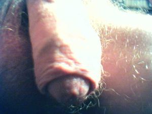 1003 sunshine break waiting for somebody who wants to have the foreskin snapping back ^^