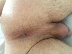 My hole