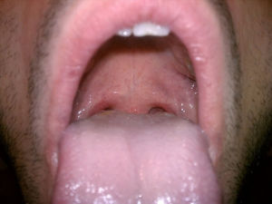 cum dump pic taken by feeder Top