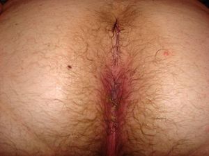 cum filled ass 2