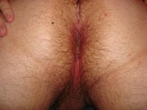 cum filled ass 1