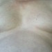 sensitive nipples
