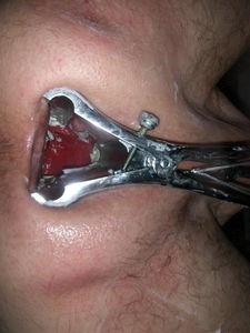 me   Speculum 04