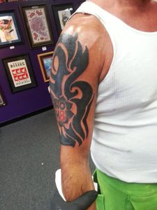 right arm post