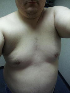 My chest area