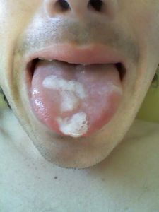 CAM00169