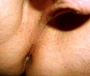 very tight hole